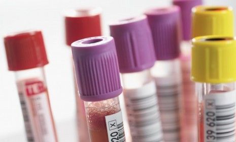 Doctors will reportedly use the new blood test initially to predict which treatments would work best for each patient&amp;#039;s specific tumor.