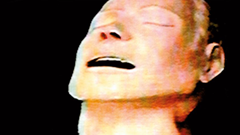 Cropped album art of Radiohead’s The Bends