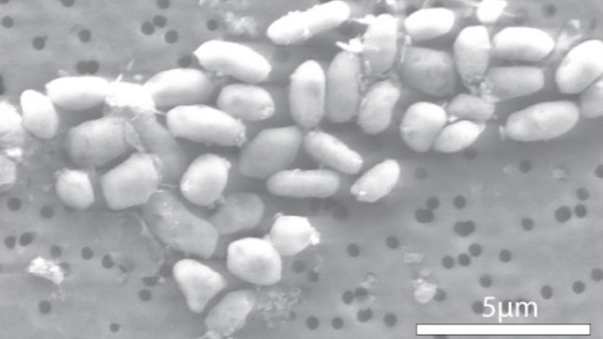 Embattled ‘arsenic lifestyles’ paper retracted through magazine Science 15 years after e-newsletter