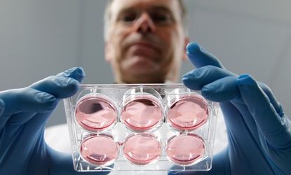 Dutch scientist Mark Post displays samples of in-vitro meat. Doesn't it look delicious?