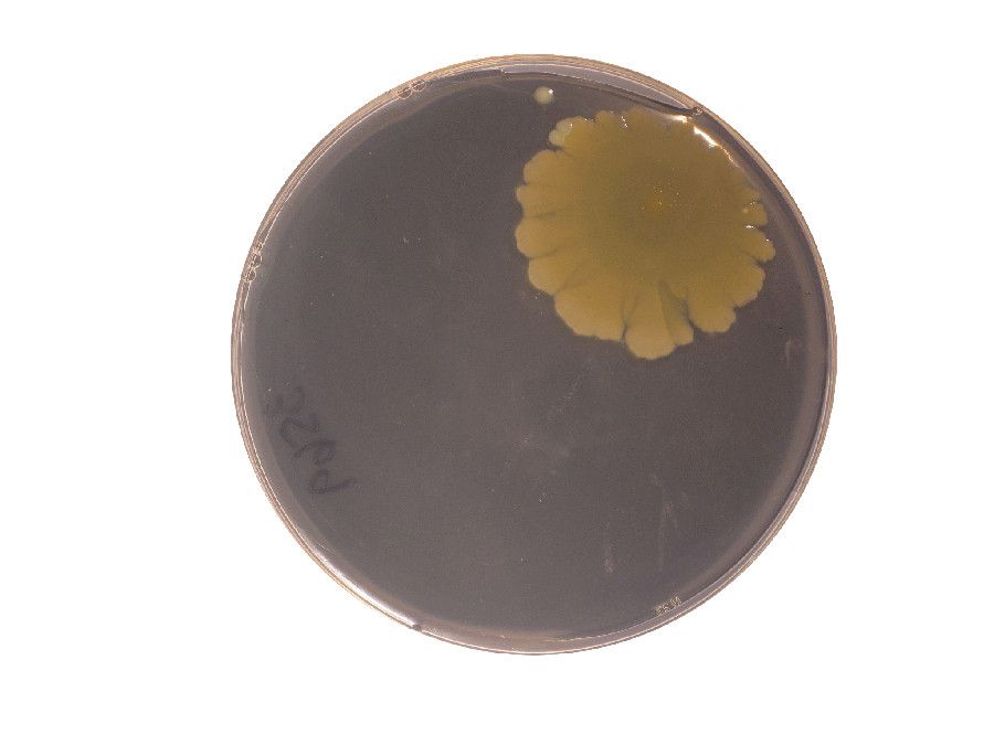 Gallery Bacteria in Your Belly Button Live Science