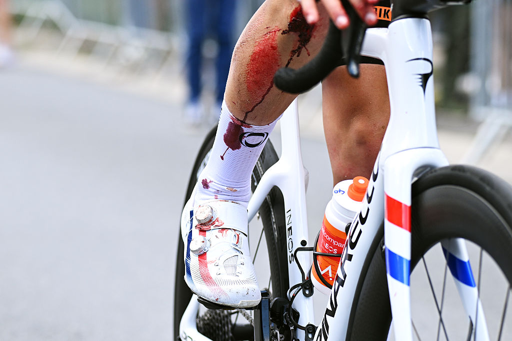 MONTROND-LES-BAINS, FRANCE - JUNE 10: (EDITOR&amp;rsquo;S NOTE: Image contains graphic content.) Detail view of Samuel Watson of Great Britain and Netcompany INEOS Cycling Team injured after the 78th Tour Auvergne-Rhone-Alpes 2026, Stage 4 a 167.4km stage from Le Puy-en-Velay to Montrond-les-Bains / #UCIWT / on June 10, 2026 in Montrond-les-Bains, France. (Photo by Dario Belingheri/Getty Images)