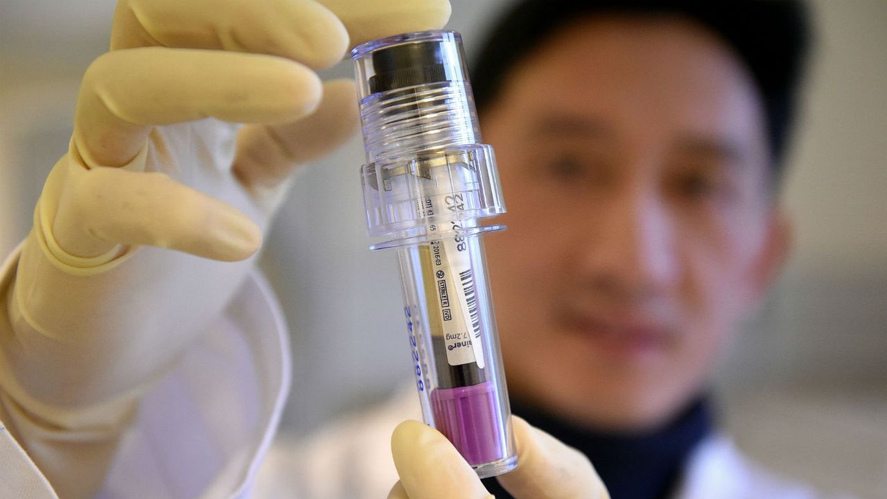 Doping tests have come under scrutiny in recent years