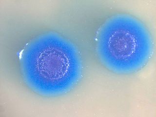 Colonies of the transformed Mycoplasma mycoides bacterium.