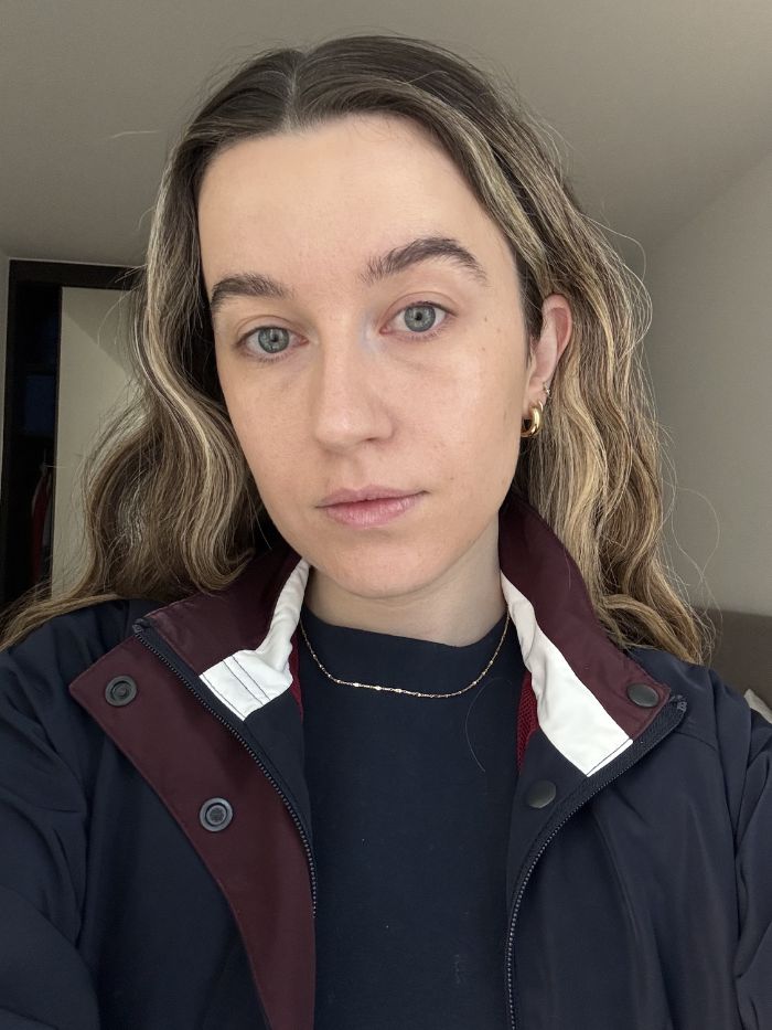 Deputy beauty editor Grace Lindsay before testing the Dr. Dennis Gross DermInfusions Lip Tint