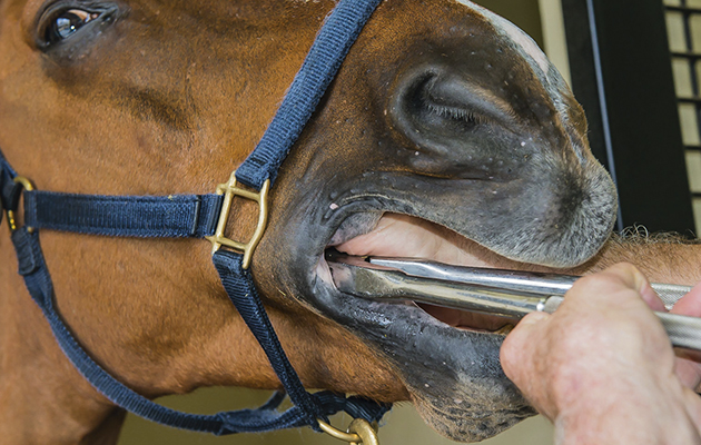tooth-extraction.jpeg
