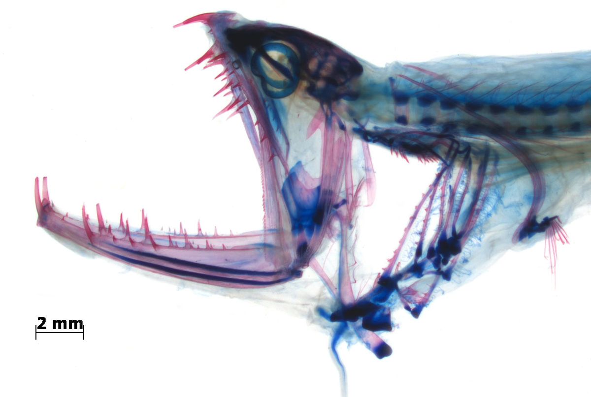 How Dragonfish Open Their Fearsome Mouths So Wide.