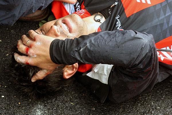 Pereiro crashed heabvily in last year's Tour de France