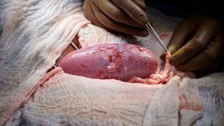 a close up of a pig's kidney being used in a transplantation experiment