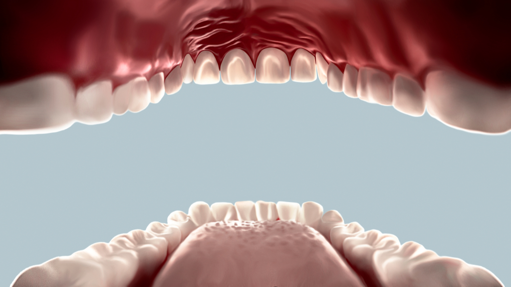 Covid 19 Infects The Mouth Could That Explain Patients Taste Loss Live Science