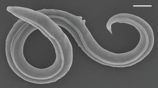 A picture of the newly thawed nematode under the microscope.