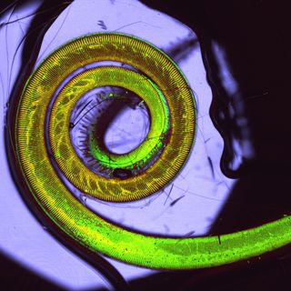microscopic image of a coiled butterfly tongue