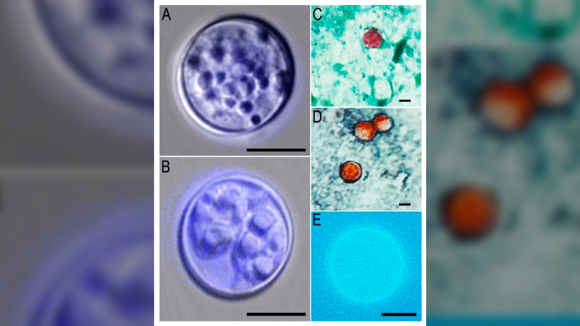 A photo of Cyclospora cayetanensis, the parasite that causes cyclosporiasis.