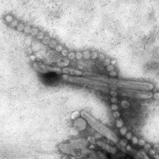 Influenza A H7N9 as viewed through an electron microscope. Both filaments and spheres are observed in this photo.