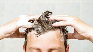 hair-loss-shampoo-man