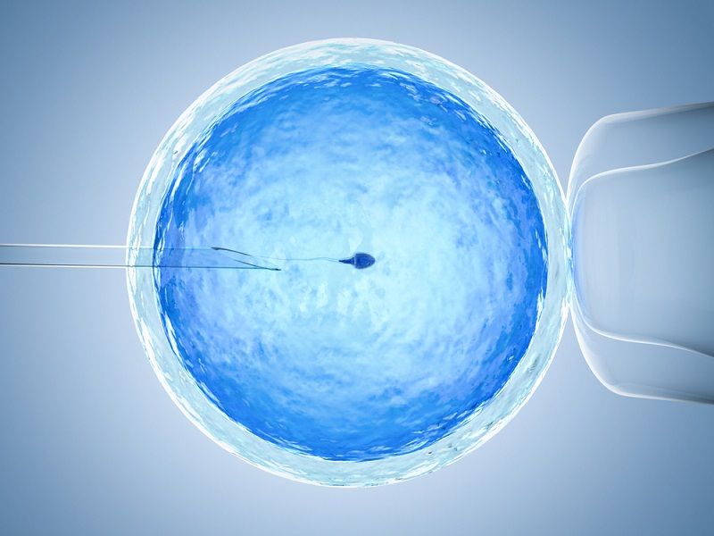 An illustration of IVF.