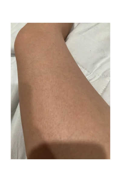Breanna S., a ‘Marie Claire’ tester, tests the Braun Skin i·expert Smart IPL