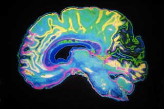 Image of brain with dark background
