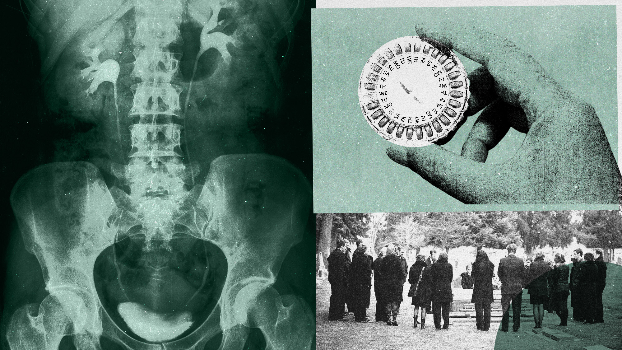 Photo collage of an x-ray image of the urinary system, a hand holding a month's worth of HRT pills, and mourners attending a funeral