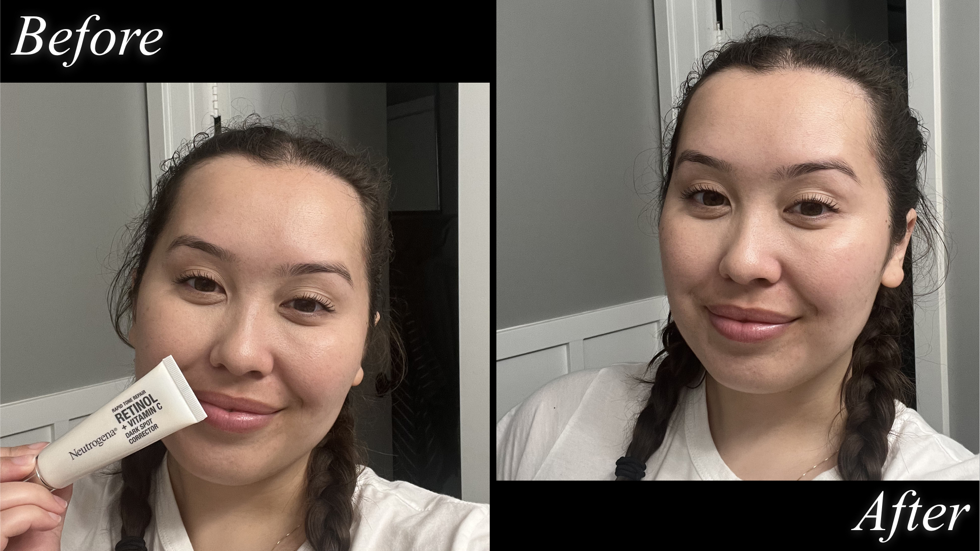 Before and after of Catharine Malzahn testing Neutrogena dark spot corrector
