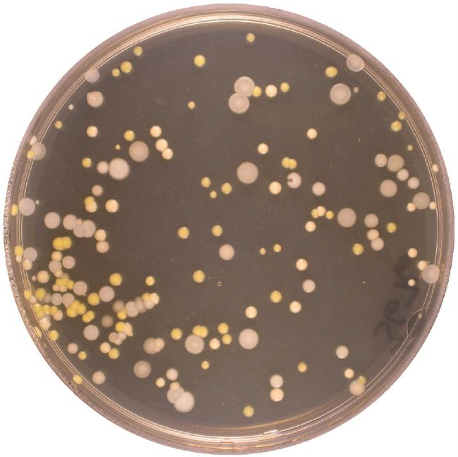 Gallery Bacteria in Your Belly Button Live Science