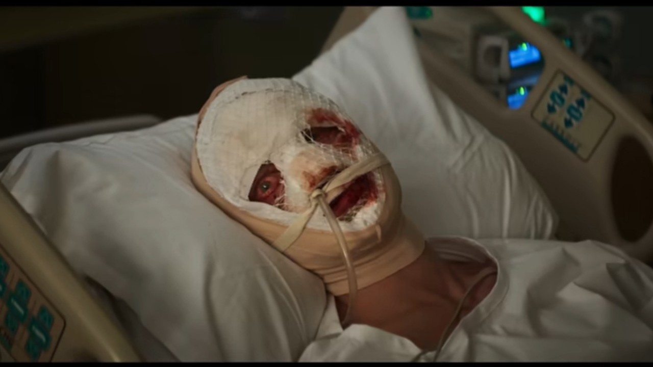 A bandaged man in Clayface