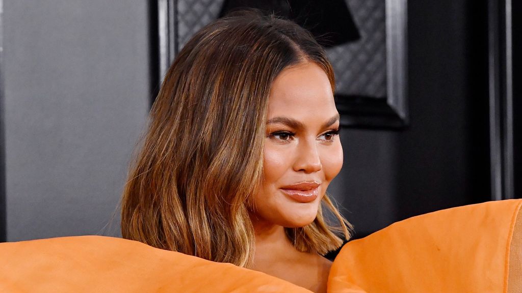 Chrissy Teigen's lips swell up after allergic reaction to ...