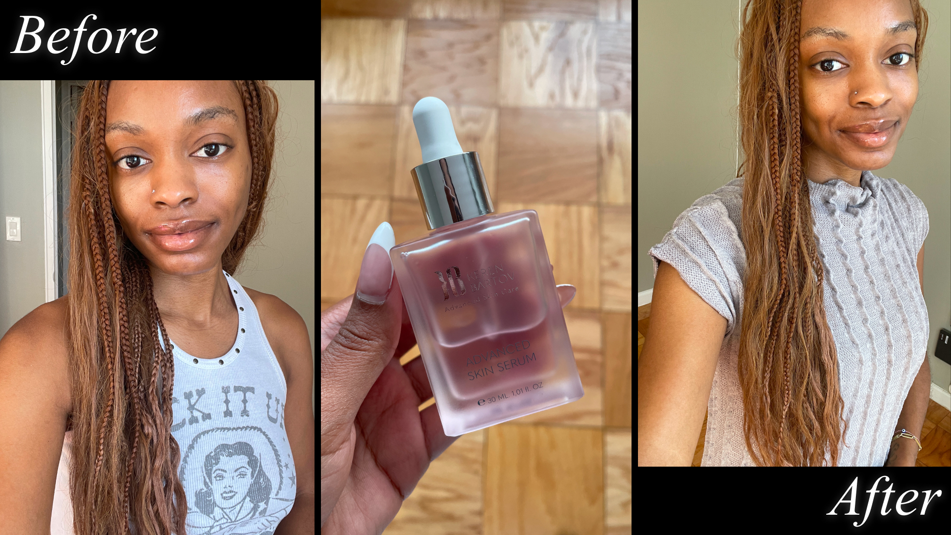 before and after photos of a person testing the keren bartov skin serum