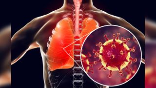 coronavirus diagram, showing the virus infecting lungs.