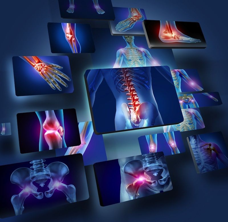 Human joints concept with the skeleton anatomy of the body.