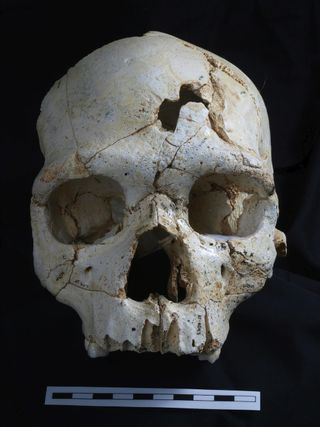 ancient skull of murder victim