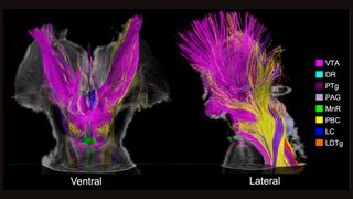 Two side-by-side mri scans showing a human brain stem at two angles with colorful neuron tracts highlighted in various colors