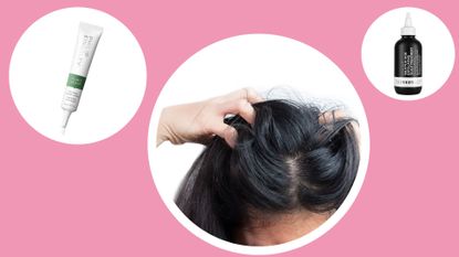 How to get rid of dandruff cover image with a woman&#039;s scalp and two products