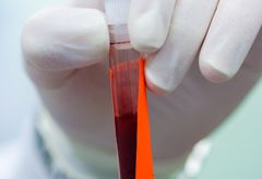 Cancer - blood test - medical - health - news