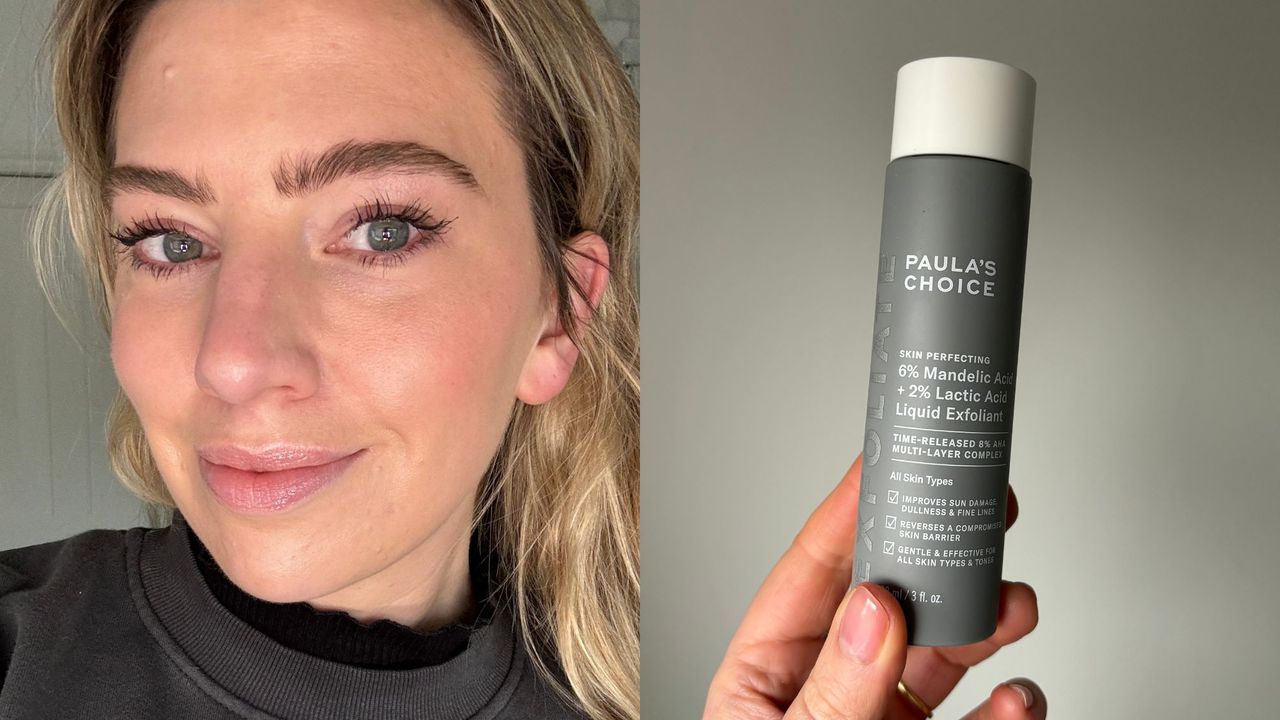 Laura&#039;s face and Laura holding Paula&#039;s Choice Mandelic Acid Liquid Exfoliant