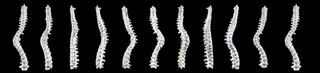 rotated richard iii spine