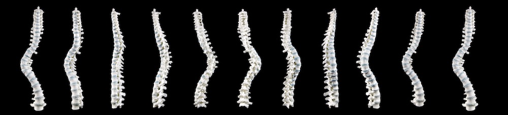 rotated richard iii spine
