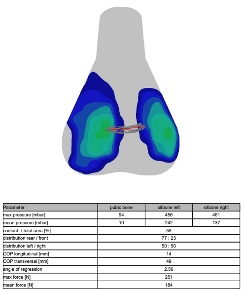 A visual output of saddle pressure mapping