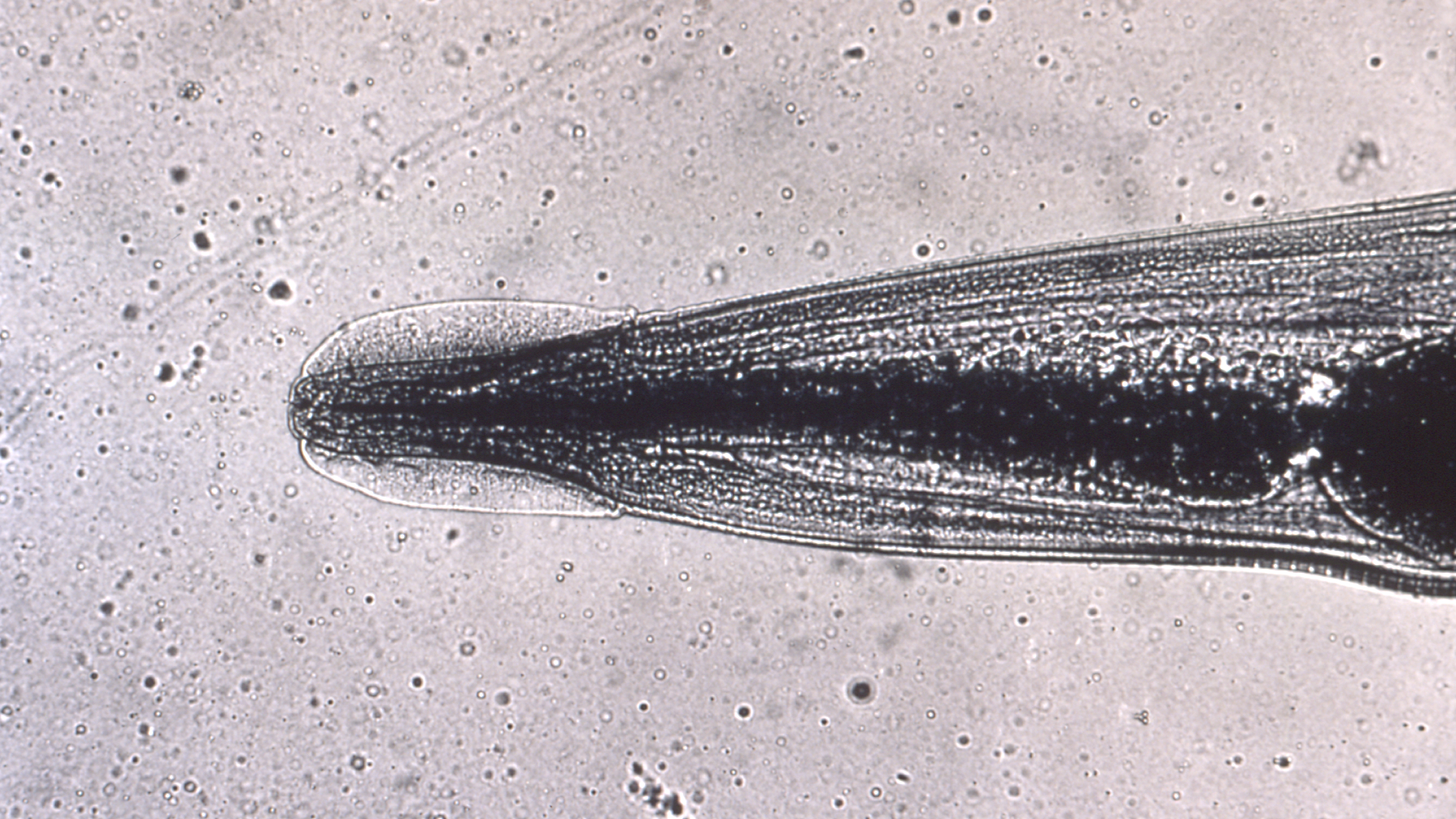 A close-up image of the parasite, Enterobius vermicularis, or human pinworm.
