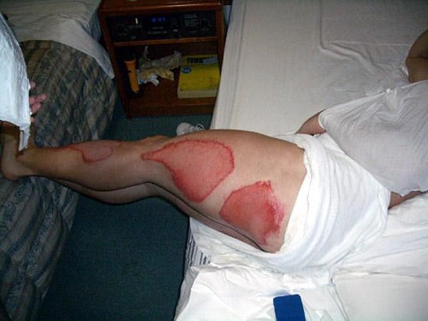 The consequences of crashing