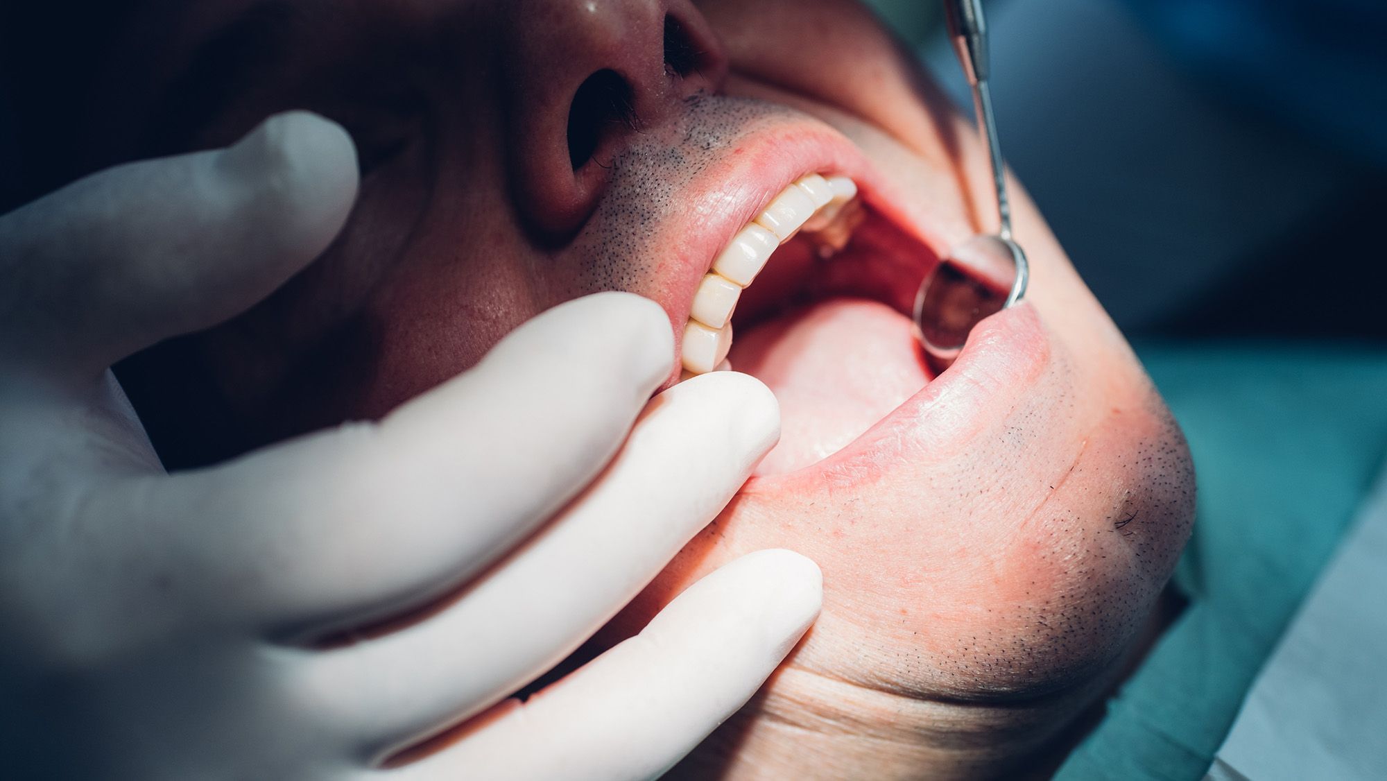Scientists find potential missing link between gum disease and worse heart health