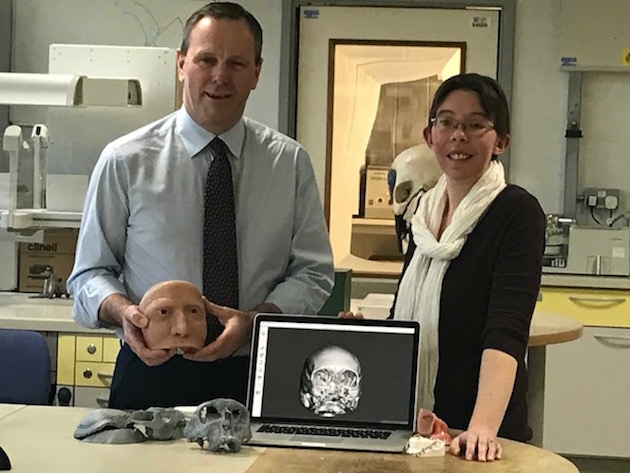 Elizabeth Calton facial reconstruction
