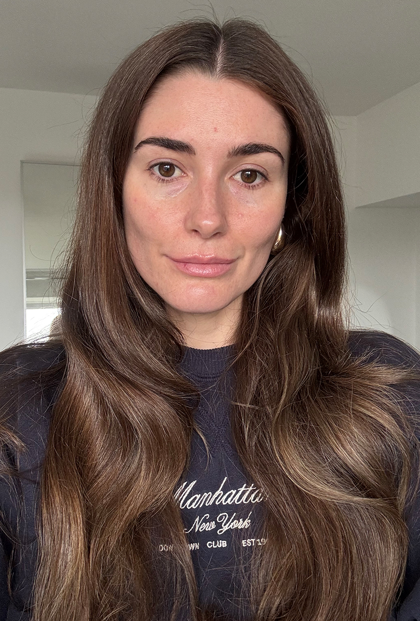 Eleanor before using Currentbody Series 2 LED Mask