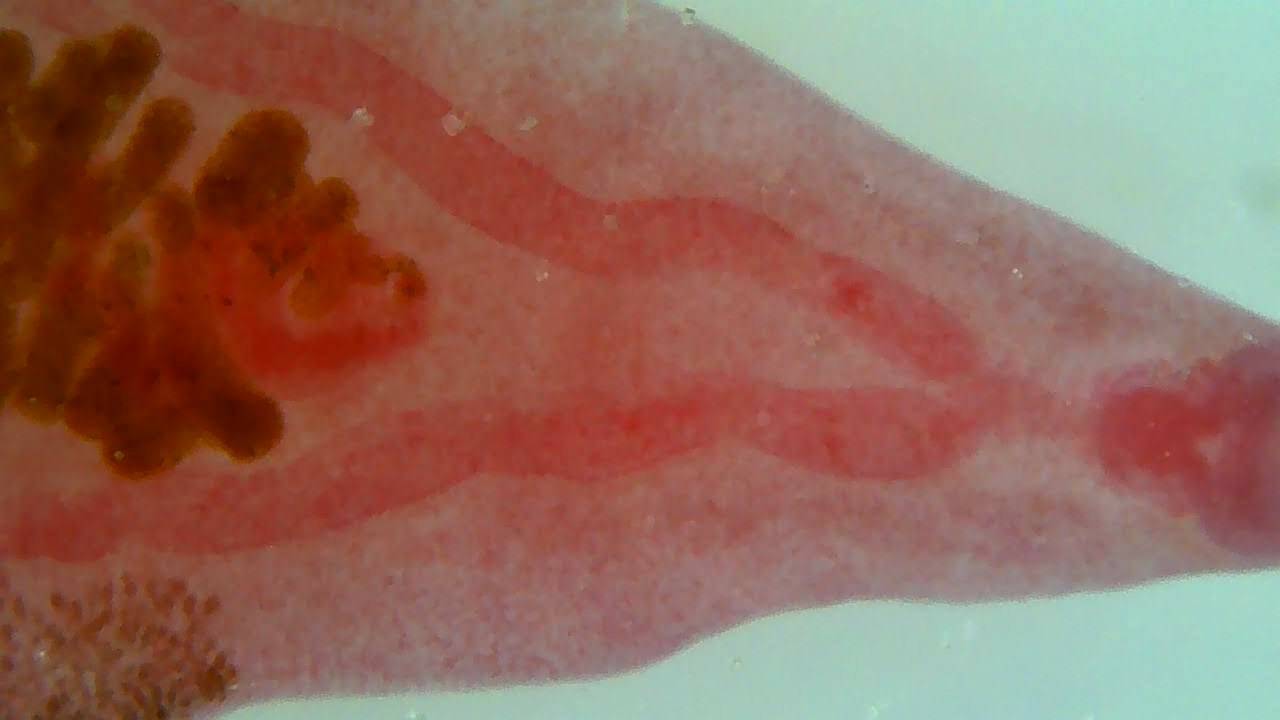 A photo of the Clonorchis parasite.