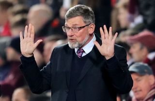 Hearts boss Craig Levein has called for perspective from Scotland fans