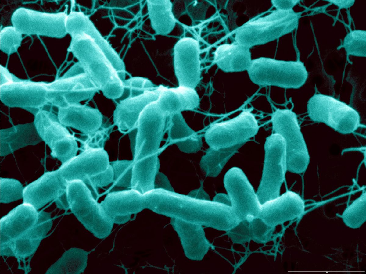 salmonella-bacteria-salmonella-bacteria-a-common-cause-of-flickr