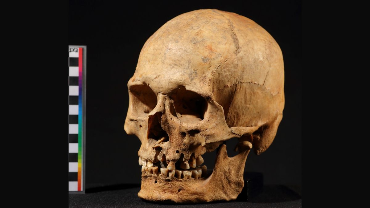 Human skull against a black background