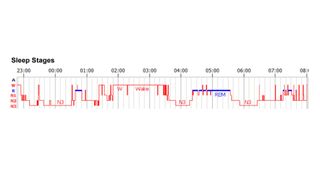 A graph showing a full sleeping period and the different sleep stages experienced in the sleep cycles