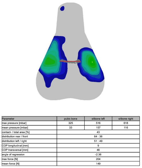 A visual output of saddle pressure mapping