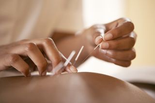When does morning sickness start illustrated by acupuncture